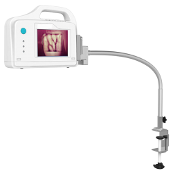 Vein Illuminator KVI-A100